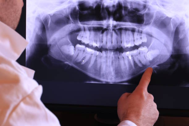 Best Emergency Broken Tooth Repair in Saxapahaw, NC